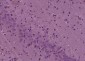 ENC1 Polyclonal Antibody