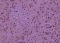 ENC1 Polyclonal Antibody