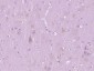 G protein beta subunit like Polyclonal Antibody