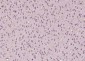 EGR2 Polyclonal Antibody