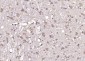 GNAI2/G protein alpha inhibitor 1 Polyclonal Antibody