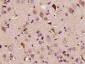 ITCH/AIP4 Polyclonal Antibody