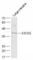 EIF2S2 Polyclonal Antibody