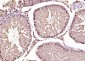 AKIRIN1 Polyclonal Antibody