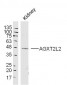 AGXT2L2 Polyclonal Antibody