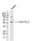AGXT2L2 Polyclonal Antibody