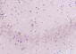 RNF70 Polyclonal Antibody