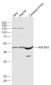 KATNA1 Polyclonal Antibody