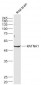 KATNA1 Polyclonal Antibody