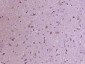 KATNA1 Polyclonal Antibody