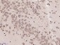 MARCH7 Polyclonal Antibody