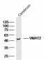 VMAT2 Polyclonal Antibody