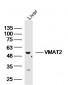 VMAT2 Polyclonal Antibody