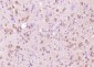 WDFY3 Polyclonal Antibody