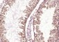 WDFY3 Polyclonal Antibody