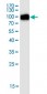 ACE2 monoclonal antibody (M05), clone CC11