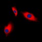 Anti-Alpha-actin-3 Antibody