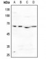 Anti-ACVR1B Antibody