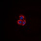 Anti-ALK1 Antibody