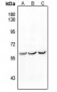 Anti-ALK1 Antibody