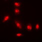 Anti-AKT (pY315) Antibody