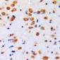 Anti-AKT (pY315) Antibody