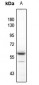 Anti-AKT (pY315) Antibody