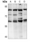 Anti-AKT2 Antibody