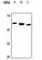 Anti-ALDH1B1 Antibody