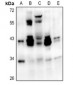 Anti-ATF1 Antibody