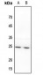 Anti-BAK Antibody