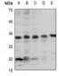 Anti-BCL2 (pT69) Antibody