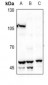 Anti-BMP3 Antibody