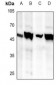 Anti-BRS3 Antibody