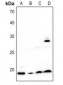 Anti-BST2 Antibody