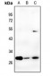 Anti-Carbonic Anhydrase 2 Antibody