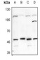 Anti-Carbonic Anhydrase 9 Antibody