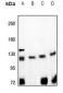 Anti-CD167a Antibody