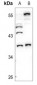 Anti-Caspase 7 Antibody