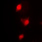 Anti-Cyclin B1 Antibody