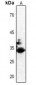 Anti-CDK2 (pT160) Antibody