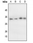 Anti-p27 Kip1 (pT198) Antibody