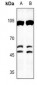 Anti-C/EBP beta Antibody