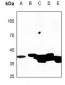 Anti-Creatine Kinase M Antibody