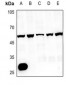 Anti-CMKLR1 Antibody