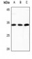 Anti-COMT Antibody