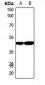 Anti-Carboxypeptidase N 1 Antibody