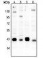 Anti-CREB (pS133) Antibody