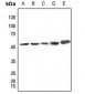 Anti-CK1 delta Antibody