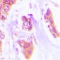 Anti-Cardiotrophin-1 Antibody